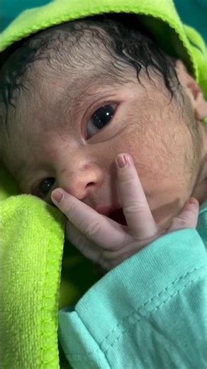 Painful Yet Beautiful Journey of Giving Birth to Twins👶💞 the Pure Magic #shorts #viral #motherhood