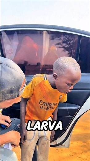 Puluhan Larva Hidup di Dalam Tubuh Anak Ini ⁉️😭