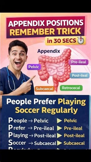 Appendix Position in 30 Seconds 🔥 | Easy Trick for MBBS Students#mbbs #medico #anatomy #neetpg