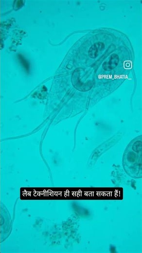 Intestinal parasites under microscope #stooltest #stools #microscope