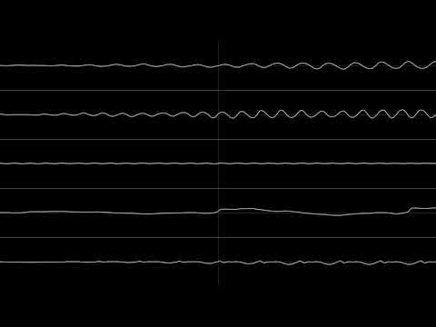 Viraxor - Hope 25 [IT module]
