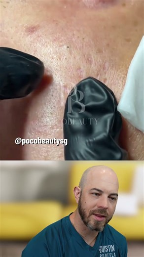 Tiny Needle, Big Payout — That Thumb Was Ready