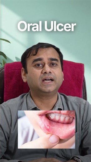 Joints aur Muscles mein Kamzori? Connective Tissue Disorder Ho Sakta Hai | Dr. Sakir Ahmed