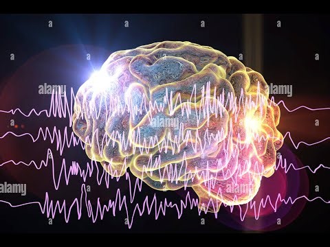 Time-frequency Based EEG Motor Imagery Signal Classification with Deep Learning Networks