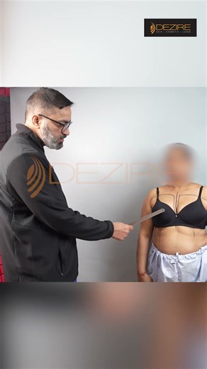 Breast Implant | Breast Implant Marking