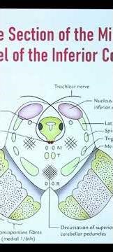 cross section at level of inferior colliculus anatomy