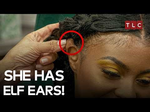 Baseball Injury Turned Nightmare | Dr Pimple Popper S2 E1