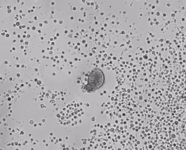 In the medicine of the future, molecular physicians built from a patient’s own cells might ferret out cancer, repair injured tissue, and even remove plaque from blood vessels. Researchers have now taken a step toward that vision: They’ve coaxed tracheal cells to form coordinated groups called organoids that can propel themselves with tiny appendages. When added to wounded neurons in the lab, these “anthrobots” helped neurons repair themselves.Learn more on #DayOfImmunology: