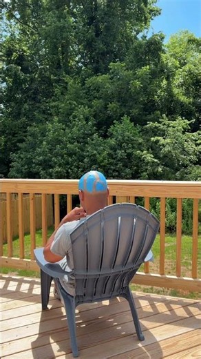 Bald Man Evens Out His Tan Lines || ViralHog
