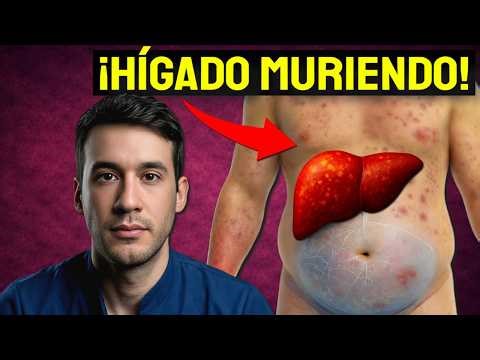 13 Señales Extrañas de ENFERMEDAD de HÍGADO que DEBES ver: ¡Hígado Muriendo!