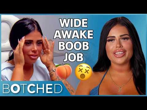 Implants Without Anesthesia?! Hailey Got A 20-Minute Boob Job While Awake | Rejected By Botched | E!