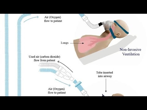 Non invasive mechanical ventilation #cpap #bipap #hypoxamia #hypercapnic #IPAP#EPAP #fypシ #fypviralシ