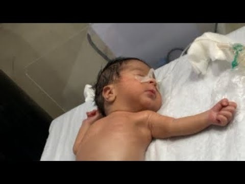 NICU Baby Recovery – Real Stories, Physio, & Shocking Transformations
