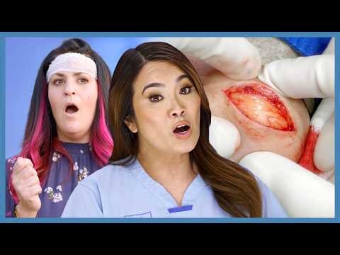 Dr Lee Removes Giant 15 Year Old Forehead Lipoma | Dr Pimple Popper