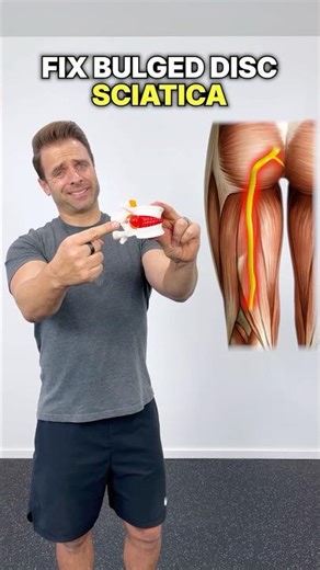Fix Bulged Disc Sciatica! [8-Min Exercise Routine]