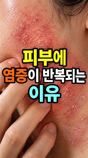 Why Skin Inflammation Keeps Coming Back
