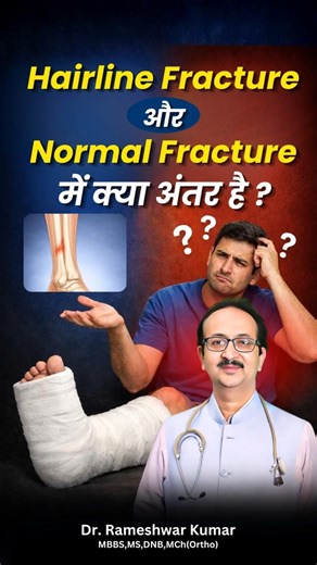 Hairline vs Normal Fracture | Key Differences Explained