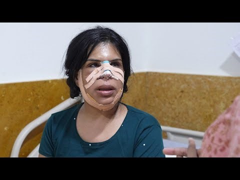 How Surgeons Sculpt the Face | Nose Slimming, Chin & Jawline Correction