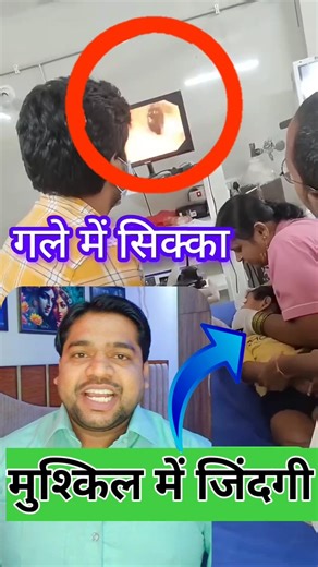 बच्चों की एंडोस्कोपी के जरिए सिक्का को बाहर निकाल #doctors #MBBS #trending #viralreels #fact #neet