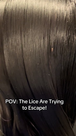 Professional Head Lice Removal Atlanta — Mobile Lice Treatment