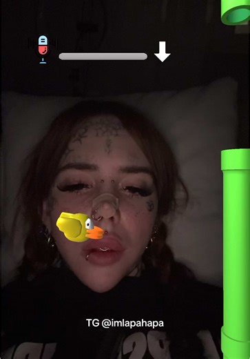 Отхожу от анастезии после лечения зубов | medical neglect teeth