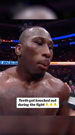 ⚠️ WARNING ⚠️ Do not watch if dental injuries disturb #ufc330