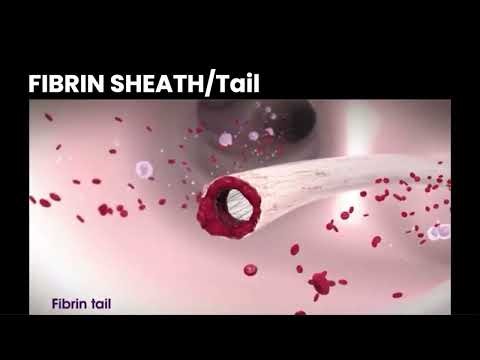 traumpunkts uznemsanas - Fibrin Foreskin.mp4