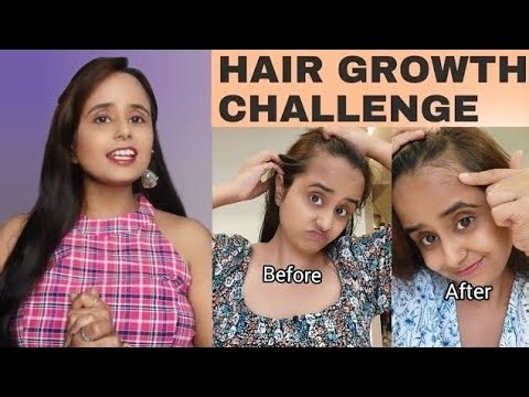 Best Hair Oil for all your Hair Concerns | Solution for Hairfall, Dandruff, Itchy Scalp & Alopecia