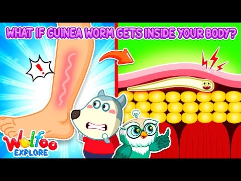 NEW | Wolfoo Explore 🔍 What If Guinea Worm Gets Inside Your Body? | Wolfoo Channel | Kids Cartoon