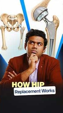 Total Hip Replacement Explained: What Actually Happens During Surgery?