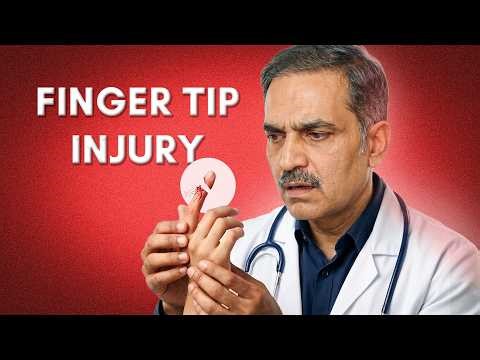 Don’t Ignore Finger Tip Injuries! 🚫 Serious Warning Signs.