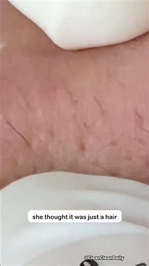 Perfect skin prep 💆