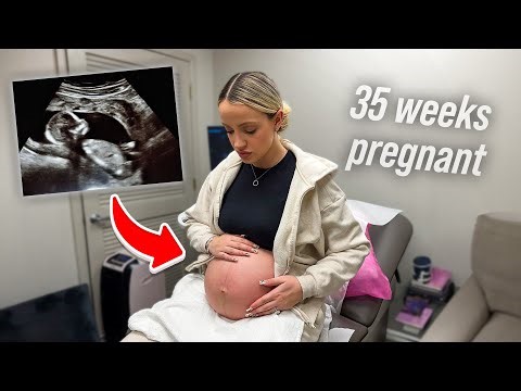 baby boy is breech... *35 week pregnancy update*