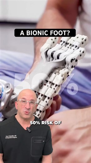 How 5 Chains Beat Traditional Prosthetics #prosthetics #comparison #technology