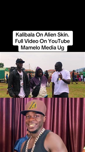 Kalibala Discusses Alien Skin Phenomenon