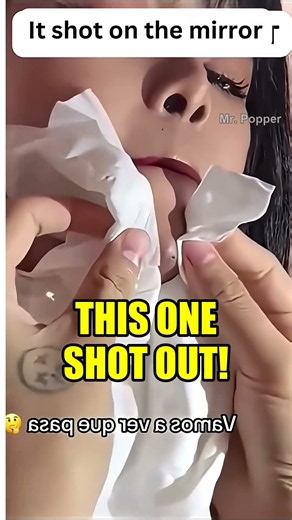 Squeezing her chin with tissue