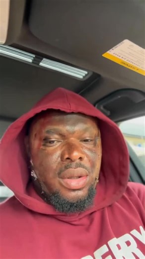 Mr.Losted❤️ Tobe🎖 on Instagram: "What is the story behind this? Una pour my hero acid?🤦🏻‍♂️😭 Anyways it’s 11:00AM, who’s active? Say “Hi”"