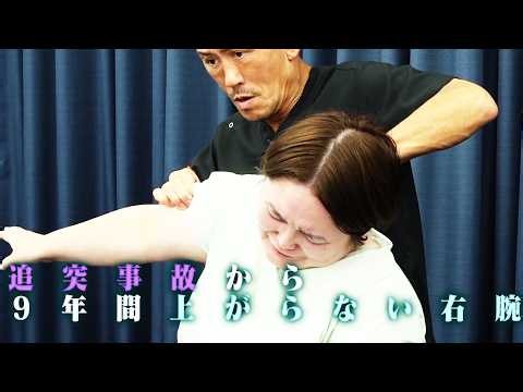 【頭にひびが入ったように痛い】「痛みで右と左で感覚が違う。」追突事故により悩み続けてきた後遺症が兼子ただしの施術で劇的改善！