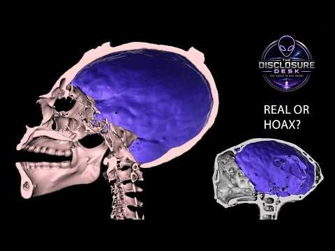 Real or Hoax? A Radiologist Just CT-Scanned the Nazca "Alien" Bodies | The Disclosure Desk Ep. 1