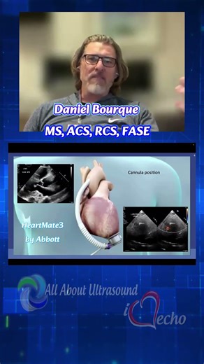 Advanced Cardiac Sonographer Mastery Course