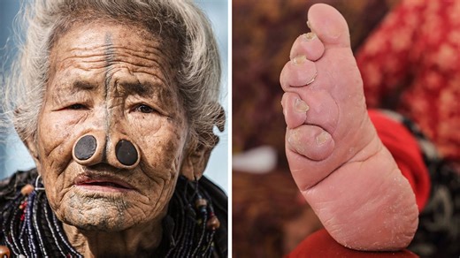 Exploring extreme body modification practices globally
