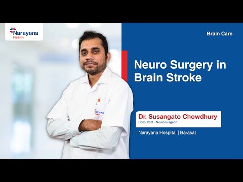 Brain Stroke Explained: Types, Complications & Treatment