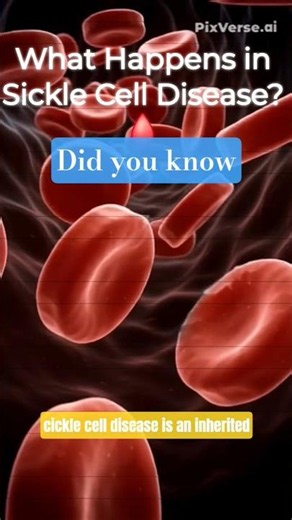 Sickle Cell Disease Explained in 15 Seconds! 🩸#shorts