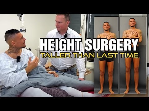 We're Cooked || Limb Lengthening World Record