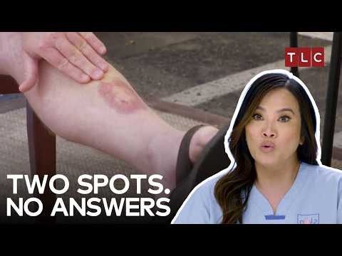 Dr. Lee Found A Mystery Even Other Doctors Missed | Dr Pimple Popper S3 E13 | TLC India