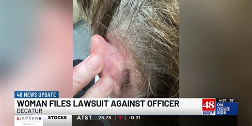 Decatur woman sues officer after arrest left her with skull fracture, brain bleed