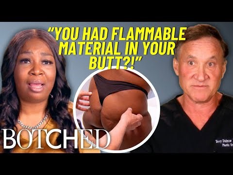 Shekea's Botched BBL Caught On FIRE During Surgery (Before & After) | Botched | E!