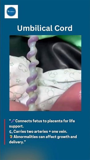 Umbilical Cord || Paediatrics || #kids #diagnosis #medicine #clinicamedica ||