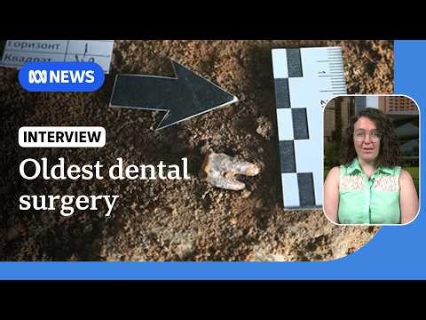 59,000-year-old tooth shows earliest evidence of dental surgery | ABC NEWS