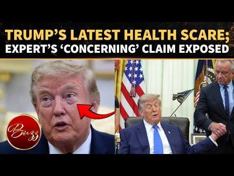 Trump’s Eyes Spark New Health Questions After President Appears To Doze Off During Briefing